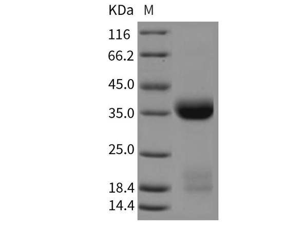 Mouse Kallikrein 1/KLK1 Recombinant Protein (RPES3906)