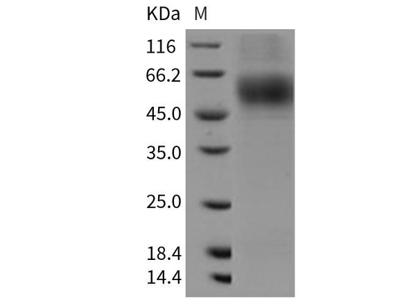 Rat MSR1/SCARA1/CD204 Recombinant Protein (His Tag) (RPES3927)