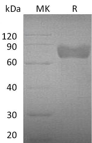 Mouse GHR/GHBP Recombinant Protein (His Tag) (Active) (RPES3979)