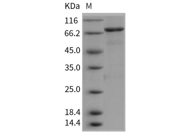 Mouse CCNE1/Cyclin-E1 Recombinant Protein (His & GST Tag) (Active) (RPES4014)