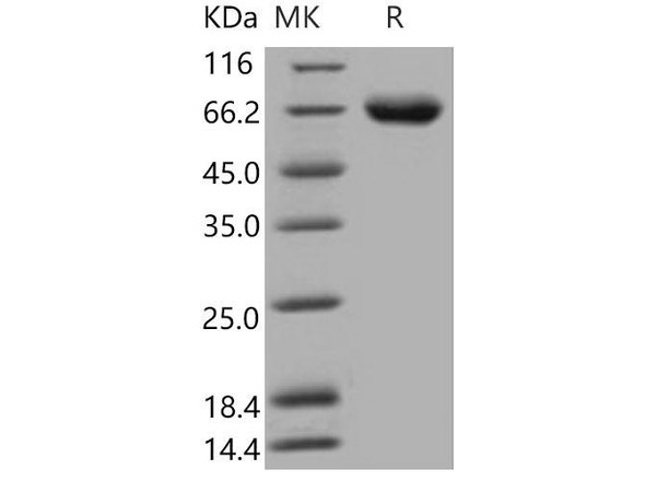 Mouse KIRREL1/NEPH1 Recombinant Protein (His Tag) (Active) (RPES4015)