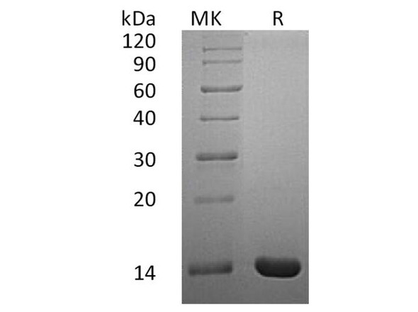 Human Interleukin-2/IL-2 Recombinant Protein (E.coli) (Active) (RPES4026)