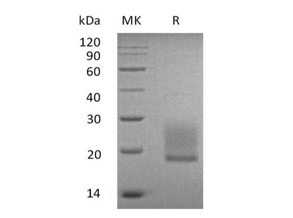 Human BTNL9/BTN3 Recombinant Protein (RPES4051)