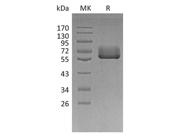 Human BTN2A2 Recombinant Protein (RPES4099)