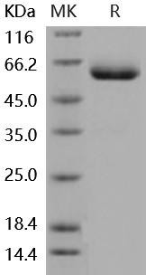 Mouse CXADR/CAR Recombinant Protein (His & Fc Tag) (Active) (RPES4139)