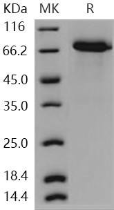 Human WFIKKN2/GASP Recombinant Protein (His Tag) (RPES4149)