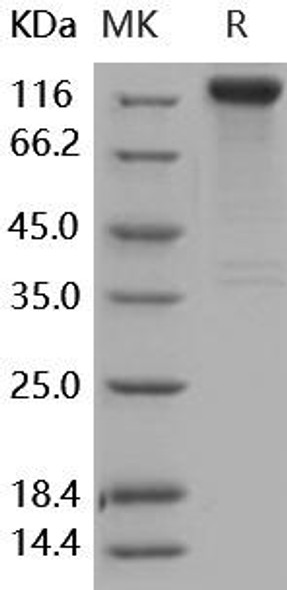 Human SLITRK1 Recombinant Protein (His & Fc Tag) (RPES4151)
