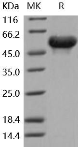 Mouse Arylsulfatase A/ARSA Recombinant Protein (His Tag) (Active) (RPES4162)