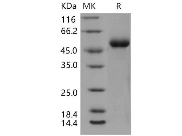 Mouse DDR1 Kinase/MCK10 Recombinant Protein (His Tag) (RPES4201)