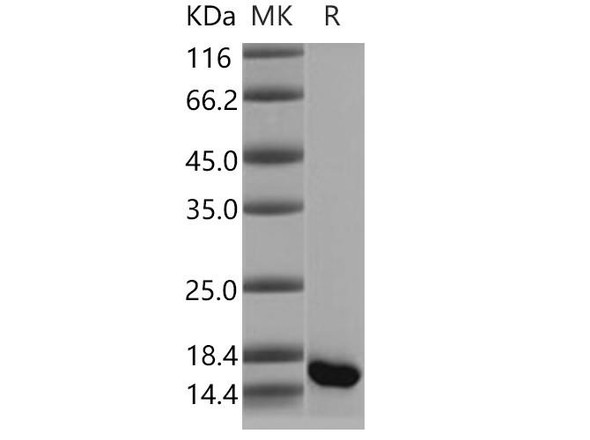 Human GMFB Recombinant Protein (RPES4203)
