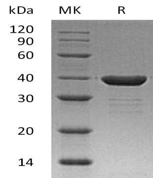 Carbonic Anhydrase 8/CA8 Recombinant Protein (RPES4327)