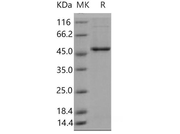 Mouse GSK3B Recombinant Protein (His Tag) (Active) (RPES4332)