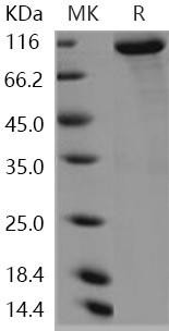 Human KEAP1/INRF2 Recombinant Protein (His & GST Tag) (RPES4343)