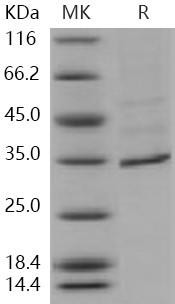 Human FANCA/FACA Recombinant Protein (His Tag) (RPES4368)