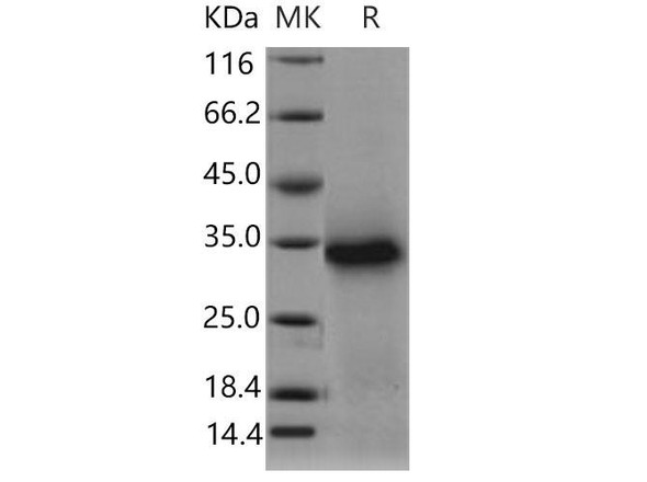 Mouse TWSG1/TSG Recombinant Protein (His Tag) (RPES4372)