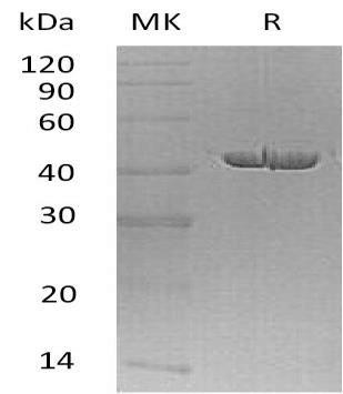 Carboxypeptidase A1/CPA1 Recombinant Protein (RPES4399)