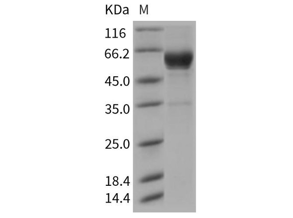 Rat CLEC4A3 Recombinant Protein (Fc Tag) (RPES4426)