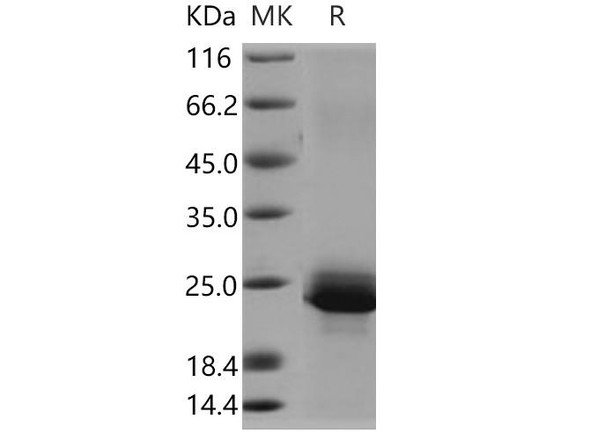Human Serglycin/SRGN Recombinant Protein (His Tag) (RPES4435)