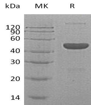 Human GABA Recombinant Protein (RPES4465)