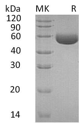 Human Carboxypeptidase M/CPM Recombinant Protein (RPES4508)