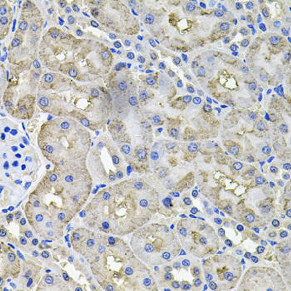 Anti-IREB1 Antibody (CAB7867)