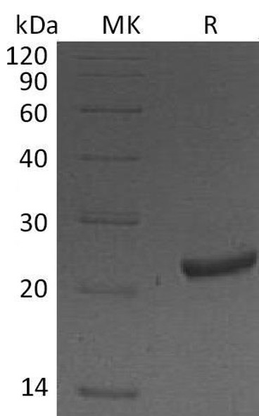 Mouse NGAL/Lipocalin-2 Recombinant Protein (His Tag) (Active) (RPES4534)