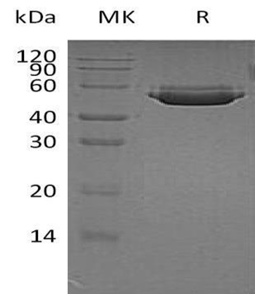 Human Cathepsin A/CTSA Recombinant Protein (RPES4592)