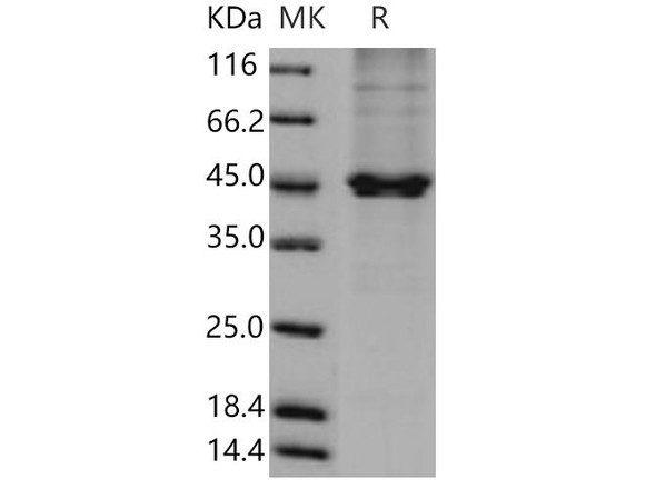 Human PON3/Paraoxonase 3 Recombinant Protein (50 Ser/Asn, His Tag) (RPES4632)