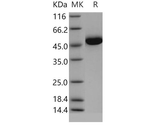 Human Gastric intrinsic factor/GIF Recombinant Protein (His Tag) (RPES4686)