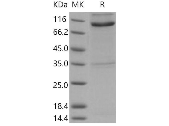 Mouse Nogo Receptor/NgR Recombinant Protein (His & Fc Tag) (Active) (RPES4712)