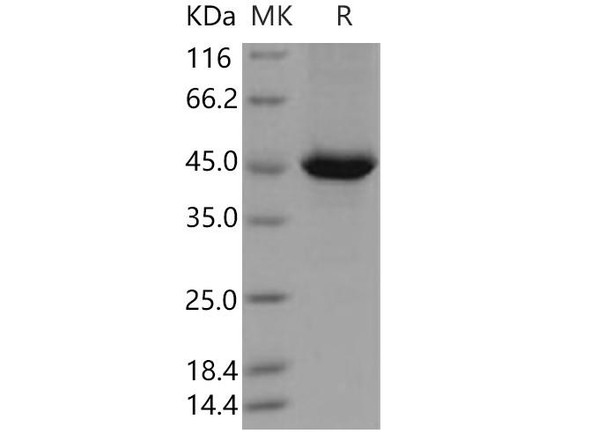 Human SerpinB4 Recombinant Protein (His Tag) (RPES4713)