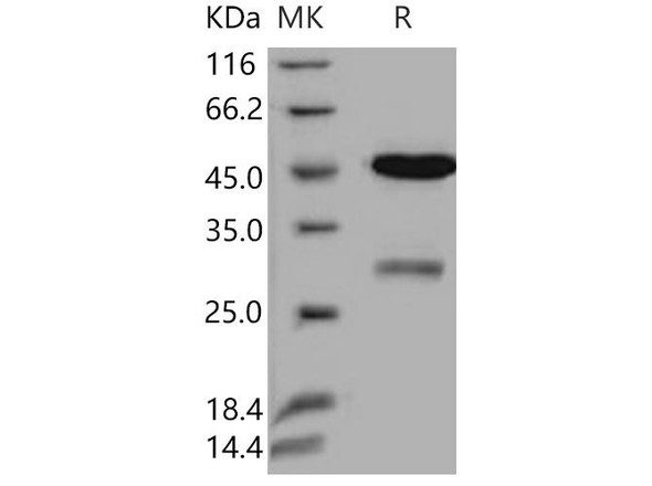 Human Uracil-DNA glycosylase/UNG Recombinant Protein (GST Tag) (RPES4736)