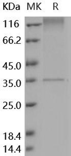 Human MERTK/Mer Recombinant Protein (RPES4759)