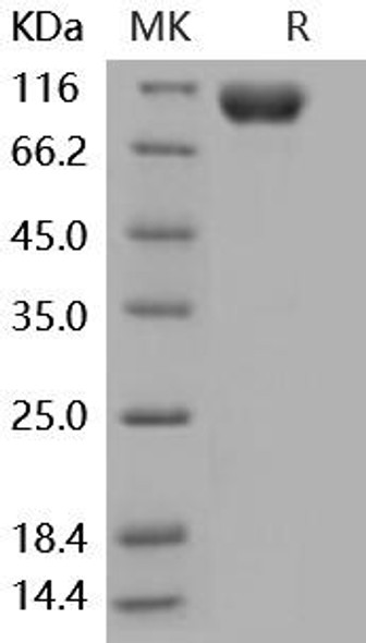 Mouse IL18R1/CD218a Recombinant Protein (RPES4800)