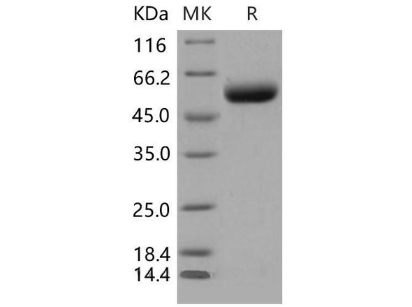 Mouse ST6GAL1 Recombinant Protein (His Tag) (Active) (RPES4839)