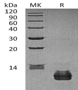Human CCL27 Recombinant Protein (RPES4864)