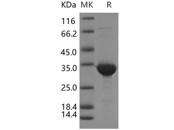 Human BVES/POPDC1 Recombinant Protein (GST Tag) (RPES4922)