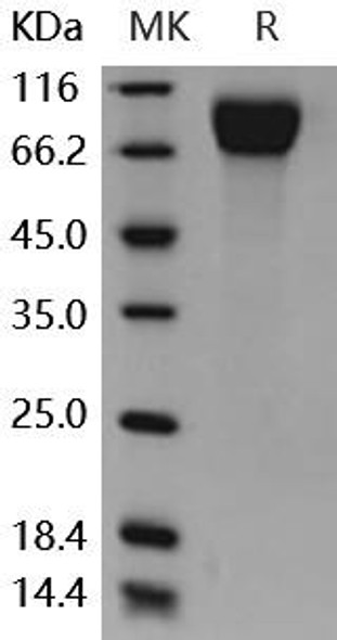 Mouse CSF1R/CD115 Recombinant Protein (His Tag) (Active) (RPES4962)