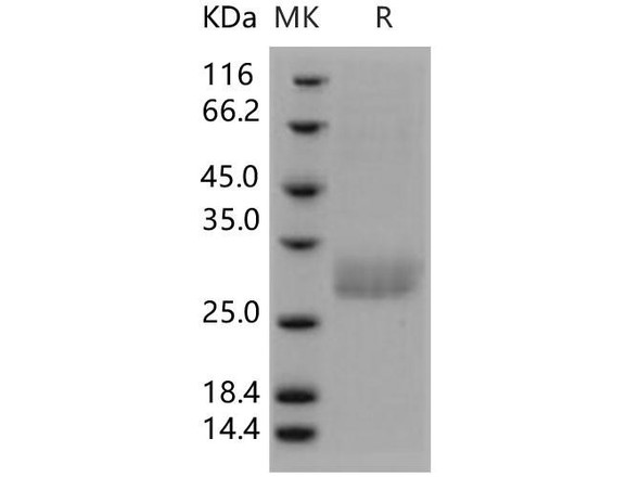 Human C1QB/C1qB Recombinant Protein (His Tag) (RPES4979)