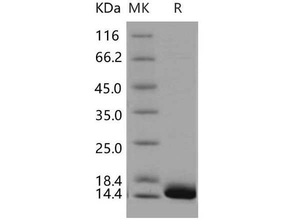 Human CALML3 Recombinant Protein (RPES4984)
