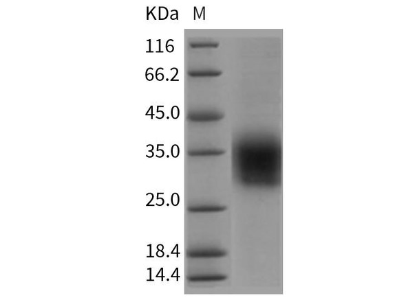 Rat CLEC4A2/DCIR Recombinant Protein (His Tag) (RPES5002)