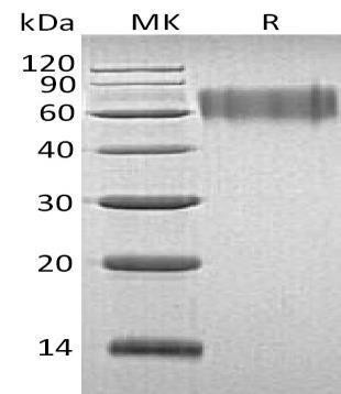 Human LYPD3 Recombinant Protein (His Tag) (RPES5018)