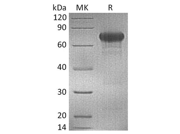 Human OX40/TNFRSF4 Recombinant Protein (RPES5037)