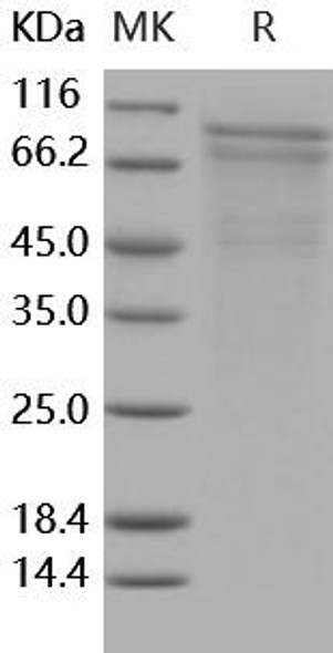 Human R-Cadherin/CDH4 Recombinant Protein (His Tag) (Active) (RPES5044)