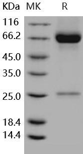 Human MMP8/CLG1 Recombinant Protein (RPES5060)
