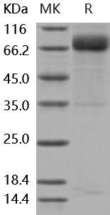 Mouse GHR/GHBP Recombinant Protein (His & Fc Tag) (Active) (RPES5063)