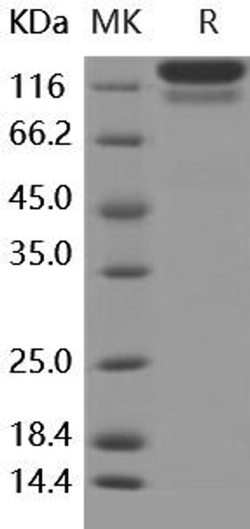 Human Fas/CD95/TNFRSF6 Recombinant Protein (Fc Tag) (Active) (RPES5065)