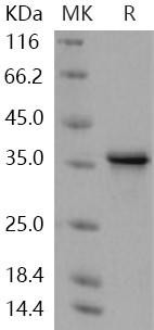 Human TWF1/Twinfilin Recombinant Protein (RPES5096)