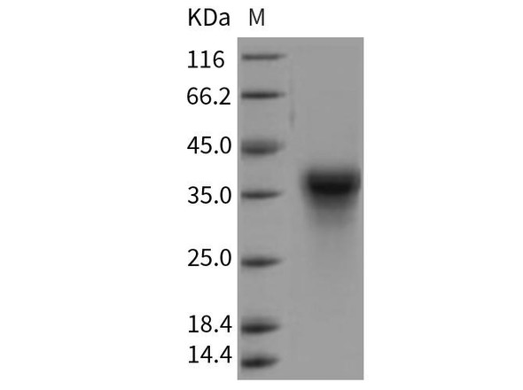 Rat CLEC5A/MDL1/MDL Recombinant Protein (His Tag) (RPES5119)