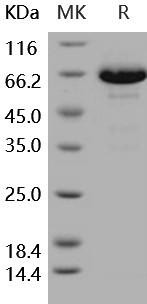 Human EphB6 Recombinant Protein (RPES5142)